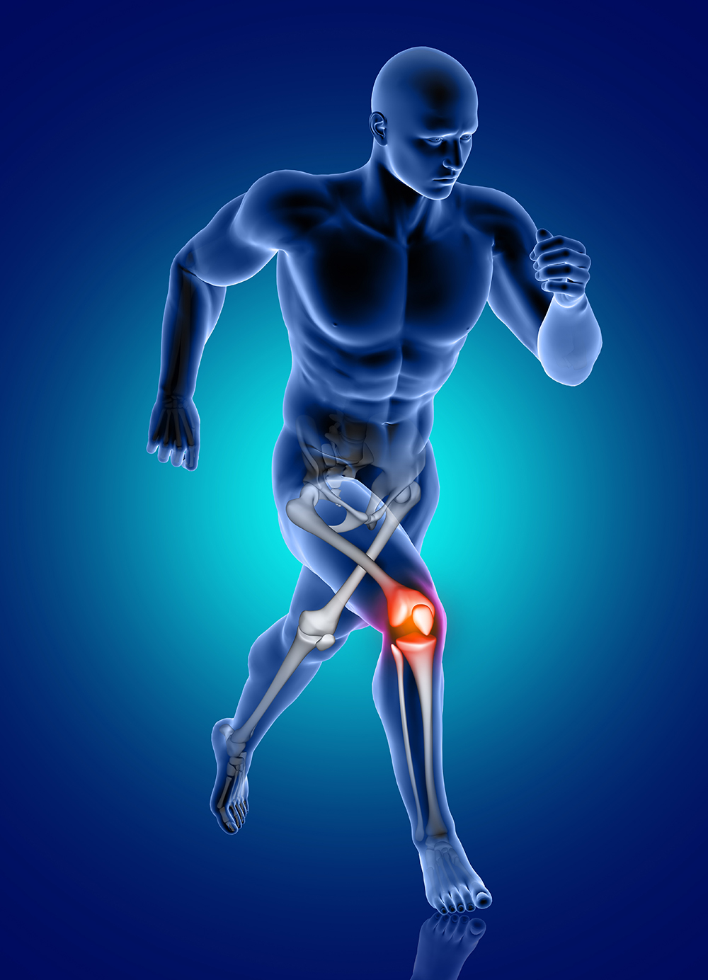 3d-male-medical-figure-running-with-knee-bone-highlighted-(1)